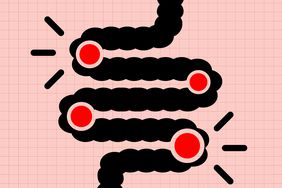 Illustration of a segmented line with red points indicating potential problem areas, resembling a gastrointestinal tract